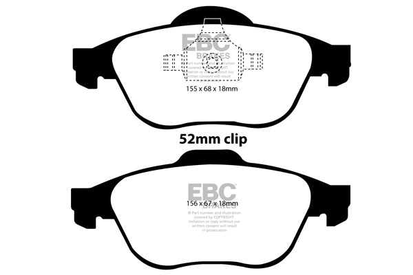Pastiglie Freno EBC Ultimax DP1394 per Renault Laguna 2, Renault Laguna 3 e altre